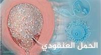 أسباب ومخاطر الحمل العنقودي 