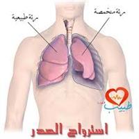 الاسترواح الصدري