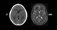 CT = التَّصوير المقطعي المُحوسَب؛ MRI = التَّصوير 